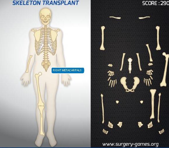 the game skeleton transplant